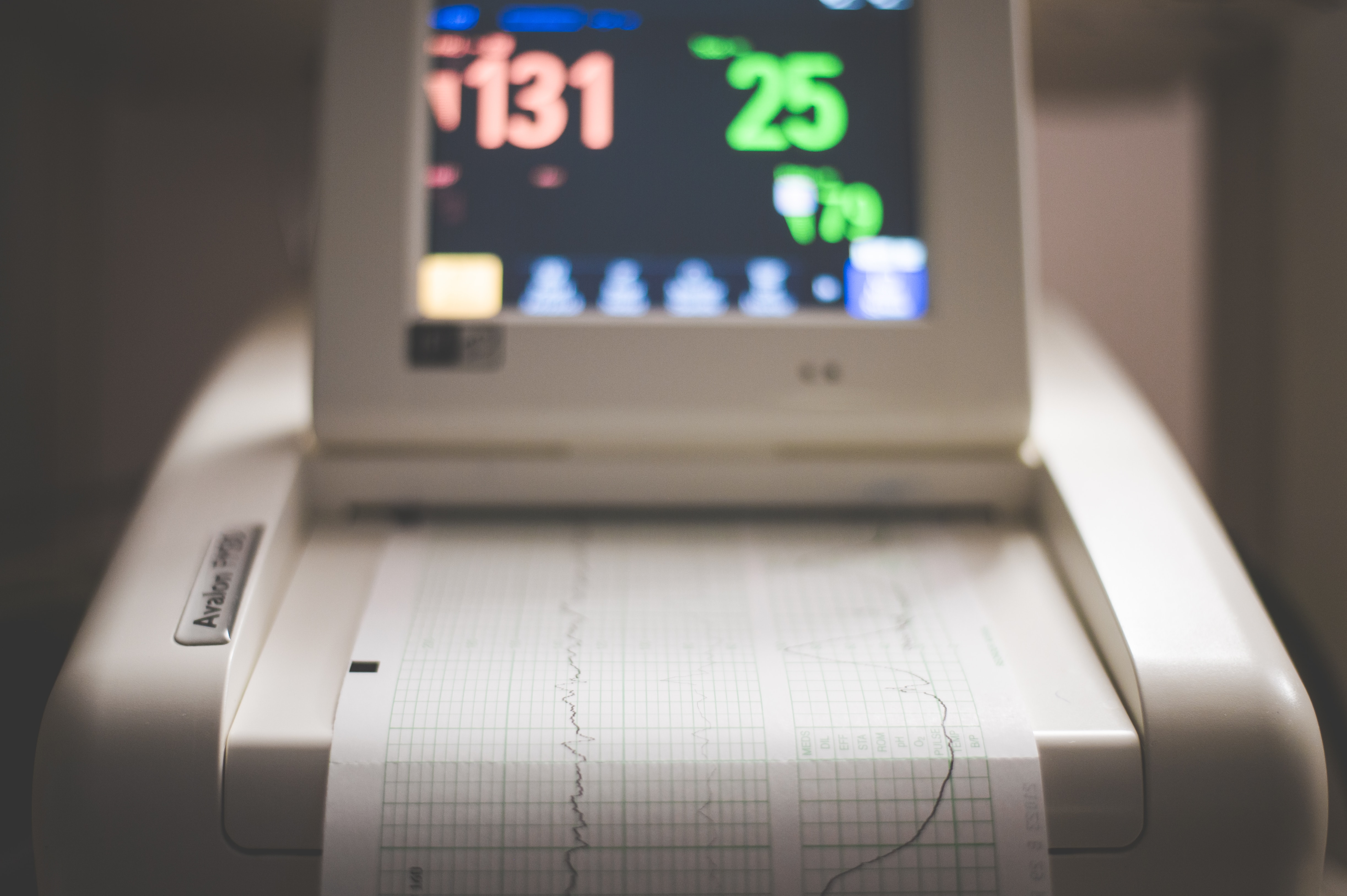 Zu sehen ist ein medizinischer Monitor, der die Herzfrequenz anzeigt. 