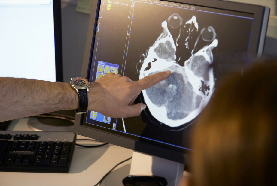 Ein Arzt zeigt auf die Innenansicht eines Gehirns an einem Computerbildschirm.